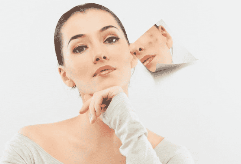 Maskne No More: Tips to Keep Your Skin Clear and Happy